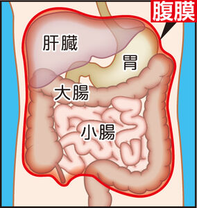 “原発性腹膜がん”とは？